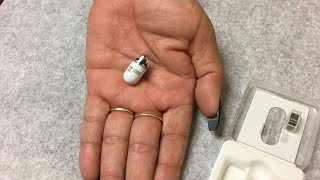 My experience with Capsule Endoscopy 112019 pillcam capsuleendoscopy [upl. by Wesley]