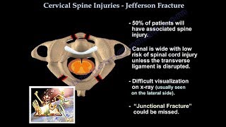 Jefferson Fracture  Everything You Need To Know  Dr Nabil Ebraheim [upl. by Ehrsam]