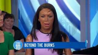 Turia Pitt Beyond The Burns  Studio 10 [upl. by Aillij]