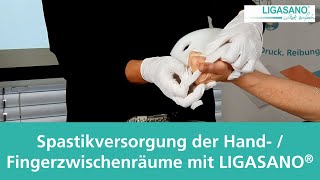 Spastikversorgung der Hand und Fingerzwischenräume mit LIGASANO® [upl. by Trilby193]