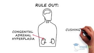 Endocrinology  Hirsutism and Hypertrichosis By Joshua Lakoff MD [upl. by Gargan]