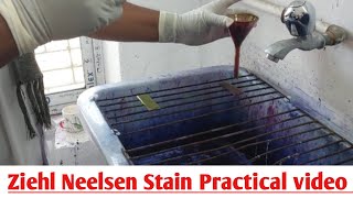 Ziehl Neelsen Stain ZN Stain  Acid Fast Staining  ZN Stain Microbiology Practical Class [upl. by Teresa]