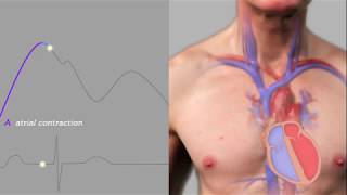 Easy Measurement of Jugular Venous Pressure [upl. by Nonez748]