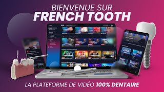 Embarquez dans la plateforme de formation vidéos 100 DENTAIRE 🦷 [upl. by Nahtiek]