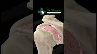 Shoulder arthroplasty animation  Total Shoulder Replacement [upl. by Amzu]