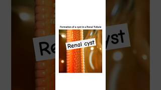 Renal cyst formation shorts mbbs femalereproductivesystem pregnancy [upl. by Eustatius611]