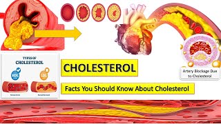 High Cholesterol  Cholesterol Normal Range  Cholesterol Explained In Urdu [upl. by Auqenehs]