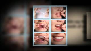 Hydrogen Peroxide Teeth Whitening [upl. by Conni499]