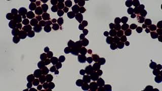 Cryptococcus neoformans in Gram stained smear of culture at various magnifications [upl. by Anada]