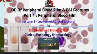 Part1  Peripheral Blood Film Lecture 3 Leukemoid blood picture [upl. by Dwight]