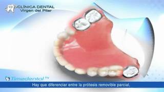 ¿Qué es una prótesis dental removible por Clínica Dental Virgen del Pilar [upl. by Htaek347]