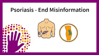 Psoriasis  End misinformation [upl. by Esinek]