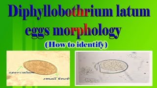 Diphyllobothrium latum eggs morphology How to identify [upl. by Lecia]