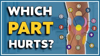 My knee hurts here 10 typical pain spots and what they mean [upl. by Felt]