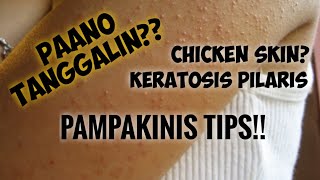 KERATOSIS PILARIS  CHICKEN SKIN  PAANO TANGGALIN ANG CHICKEN SKIN  TUTORIAL [upl. by Ilenay]