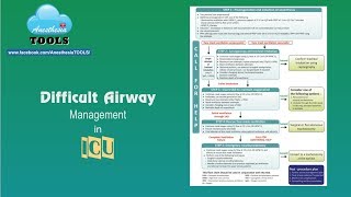 Difficult airway algorithm for ICU [upl. by Briant]