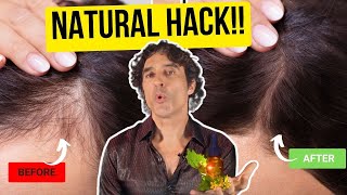 HAIR LOSS Doctor Tips to Naturally Prevent Hair Loss amp Regrow Hair [upl. by Horner]