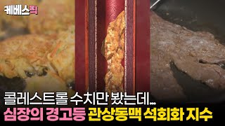 생로병사의비밀 심장의 경고등 관상동맥 석회화 지수 │ KBS 240925 방송 [upl. by Purington897]