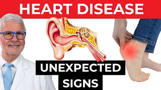 OVERLOOKED Signs Of Heart Disease DO NOT IGNORE  Dr Gundry [upl. by Parnas584]