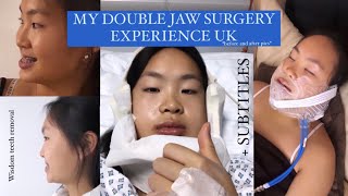 Double jaw surgery amp wisdom teeth extraction before amp after UK  WEEK 1 [upl. by Nath426]