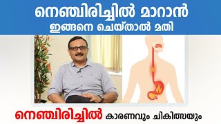 നെഞ്ചിരിച്ചിൽ മാറാൻ ഇങ്ങനെ ചെയ്താൽ മതി  Acid reflux malayalam  Gas Trouble [upl. by Benenson]