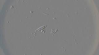 Diatoms in action [upl. by Sybilla]