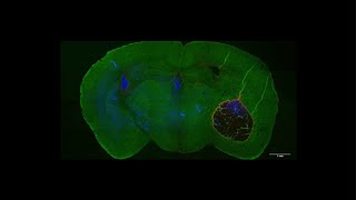 Identifying how a fungus causes damage to the brain [upl. by Jt]