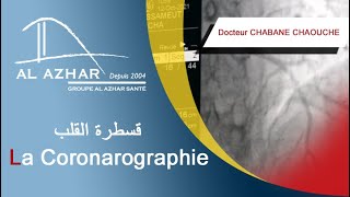 La Coronarographie قسطرة القلب [upl. by Lenna]