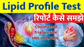 Lipid profile test in Hindi I Lipid profile Test Report कैसे समझे I [upl. by Sharon881]