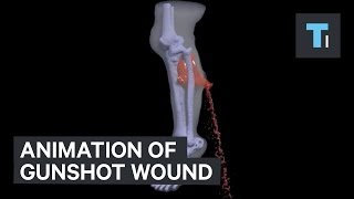 Animation of gunshot wound [upl. by Ted828]