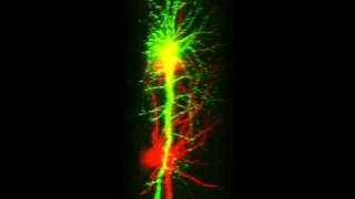 Double labeled neurons of brain slices [upl. by Eecyak242]