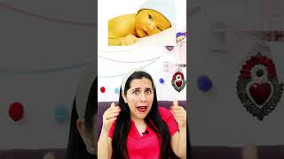 ¿Qué es la Ictericia neonatal shortsyoutube [upl. by Elnora]