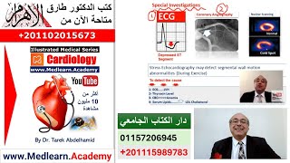 Angina Pectoris cme internalmedicine ecg usmle medical محاضراتباطنة [upl. by Svetlana]