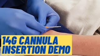 Large 14G cannula insertion technique  Live Demo [upl. by Akira]