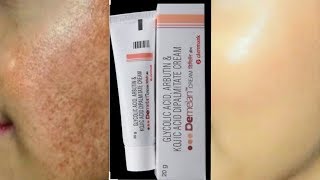 Demelan cream Remove pigmentation Acne scars pimple marks [upl. by Hayilaa757]