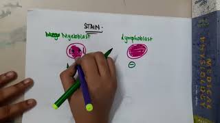 myeloblast vs lymphoblast  Hematology [upl. by Sualohcin238]