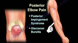 ELBOW PAIN  COMMON CAUSES  Everything You Need To Know  Dr Nabil Ebraheim [upl. by Aisor314]