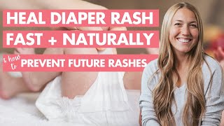 FAST  NATURAL Diaper Rash Treatment Every Parent Should Know [upl. by Wilhelmine]