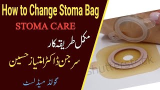 How to Change Stoma Bag in Patient with two piece pouching system  Surgeon Dr Imtiaz Hussain [upl. by Calen]