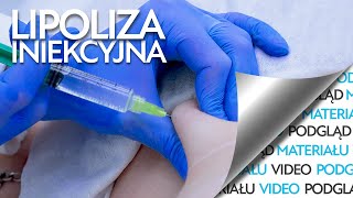 Zabieg wyszczuplający czyli lipoliza iniekcyjna [upl. by Sibell]