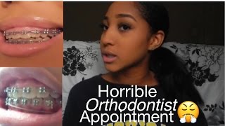 My HORRIBLE orthodontist appointment STORYTIME Braces update [upl. by Cung540]