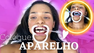 VLOGColocando Aparelho nos dentes Nathy Soares [upl. by Alo]