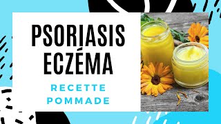 Psoriasis eczéma recette cicatrisante facile pommade maison [upl. by Haraf424]