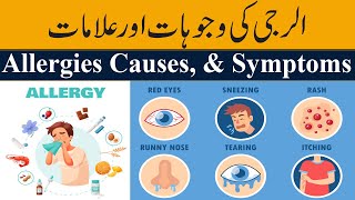 What is Allergy  Causes Signs and Symptoms Must Watch [upl. by Claudette]