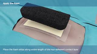 Application Animation Medela NPWT Dressing CSI Foam [upl. by Roee]