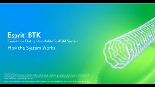 Learn how the Esprit™ BTK Everolimus Resorbable Scaffold System works [upl. by Feeney615]