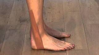 Effective sports taping for peroneal tendonitis [upl. by Ahseele]