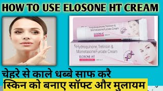 how to use ELOSONE HT cream सबसे ज्यादा उसे होने वाली क्रीम elosone ht [upl. by Otilopih]