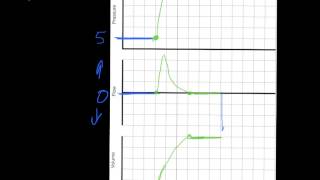 Ventilator Mode amp Waveforms Review [upl. by Emarej]