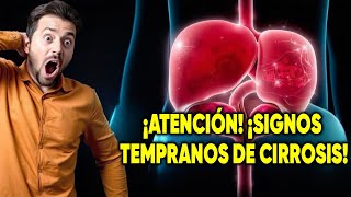 ¡CUIDADO ASÍ comienzan los síntomas de la CIRROSIS y nadie te lo cuenta [upl. by Adigirb]